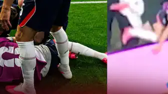 İngiltere Milli Takımı Teknik Direktörü Thomas Tuchel: "Sakatlık çok ciddi görünüyor"